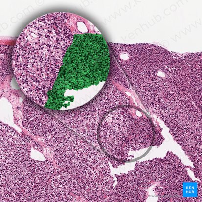 Dense principal cell (Parathyrocytus endocrinus densus); Image: 