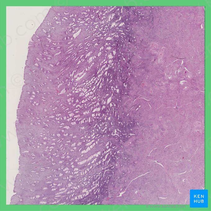 Secretory phase (uterus) (Phasis secretoria (Uterus)); Image: 