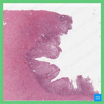 Late proliferative phase (Uterus) (Phasis proliferativa tarda (Uterus)); Image: 