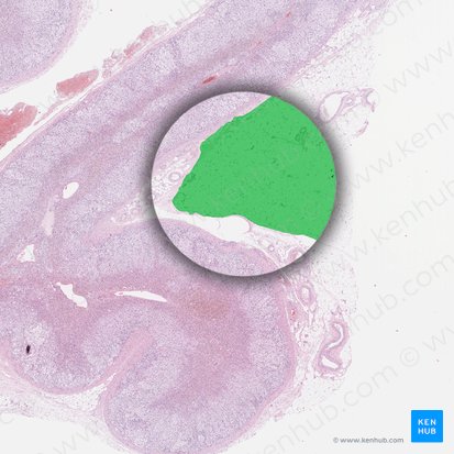 Periadrenal fat (Textus adiposus periadrenalis); Image: 