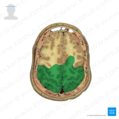 Lobus parietalis (Scheitellappen); Bild: National Library of Medicine