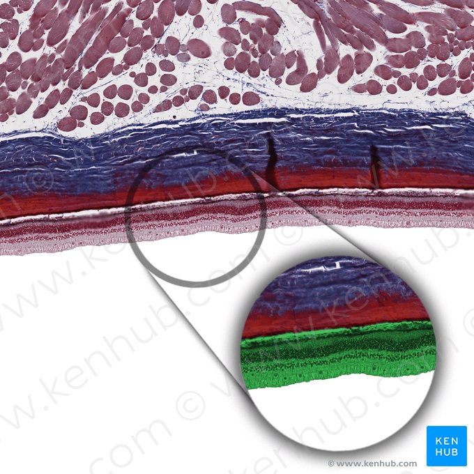 Retina; Image: 