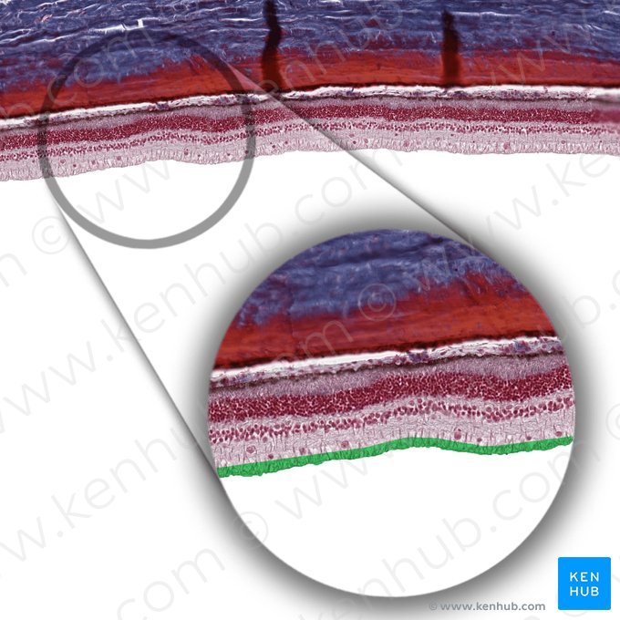Layer of nerve fibers of retina (Stratum neurofibrarum retinae); Image: 
