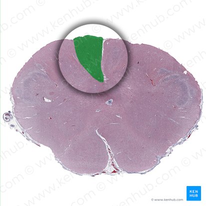 Núcleo grácil (Nucleus gracilis); Imagen: 