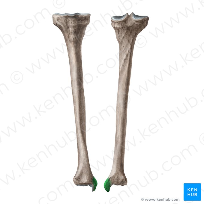 Medial malleolus of tibia (Malleolus medialis tibiae); Image: Liene Znotina