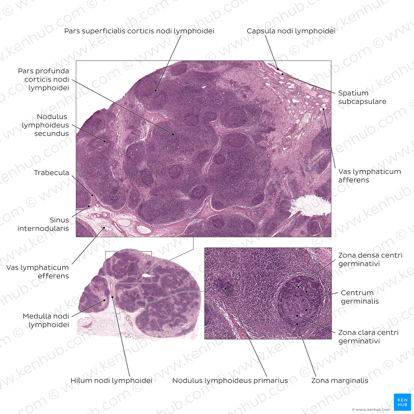 Lymphknoten
