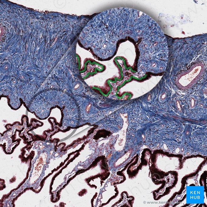 Pigmented epithelium of ciliary body (Epithelium pigmentosum corporis ciliaris); Image: 