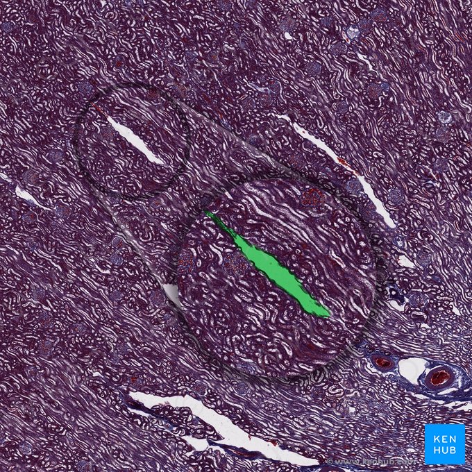 Interlobular vein (Vena interlobularis); Image: 