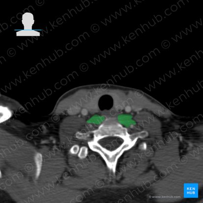 Longus colli muscle (Musculus longus colli); Image: 