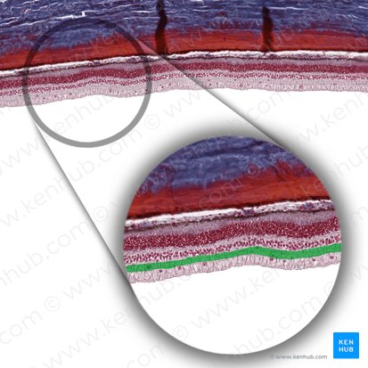 Stratum plexiforme internum retinae (Innere plexiforme Schicht der Netzhaut); Bild: 