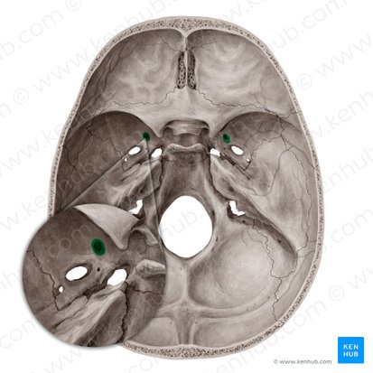 Foramen rotundum; Image: Yousun Koh