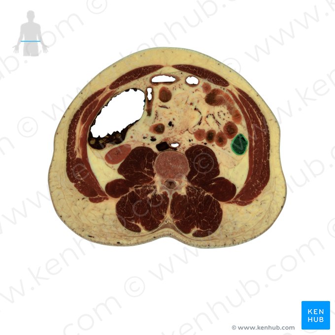 Descending colon (Colon descendens); Image: National Library of Medicine
