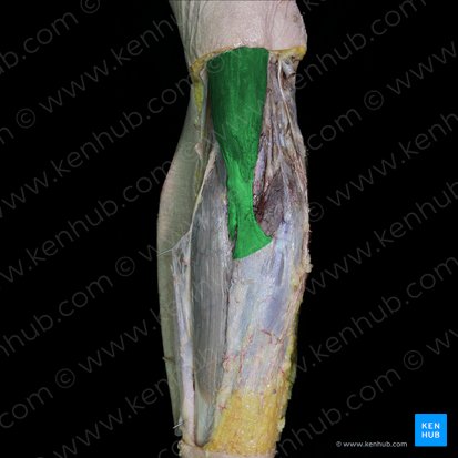 Musculus biceps brachii (Zweiköpfiger Oberarmmuskel); Bild: 