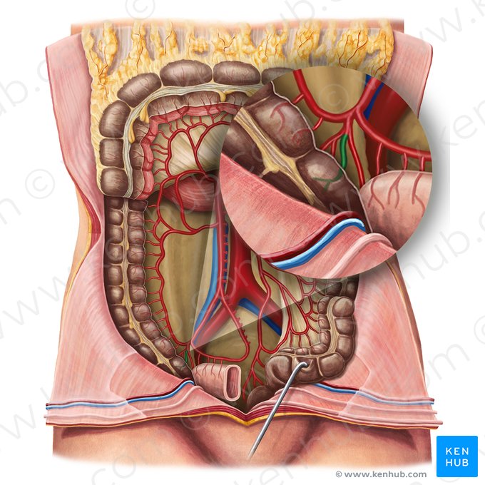Anterior cecal artery (Arteria caecalis anterior); Image: Irina Münstermann