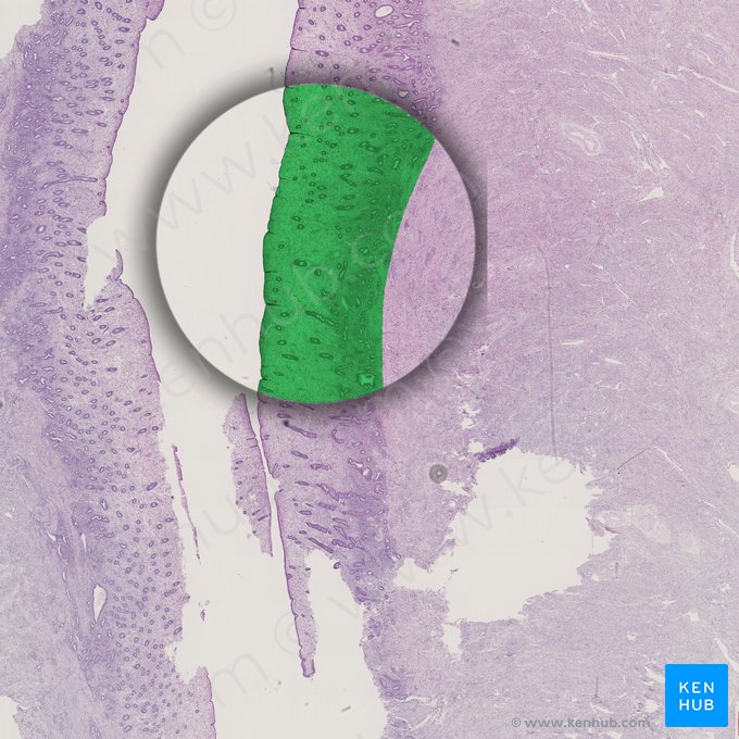 Endometrium; Image: 