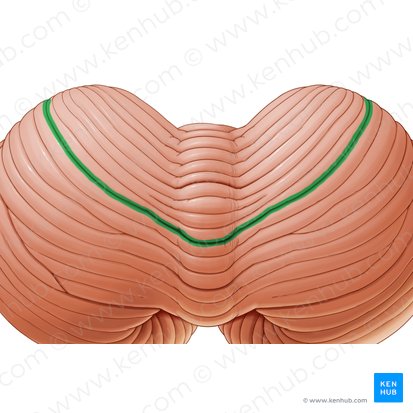 Primary fissure of cerebellum (Fissura prima cerebelli); Image: Paul Kim