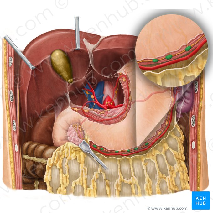Right gastroomental lymph nodes (Nodi lymphoidei gastroomentales dextri); Image: Begoña Rodriguez