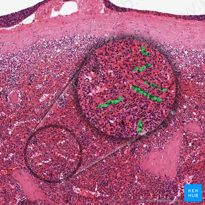 Vas sinusoideum splenicum (Milzsinusoide); Bild: 