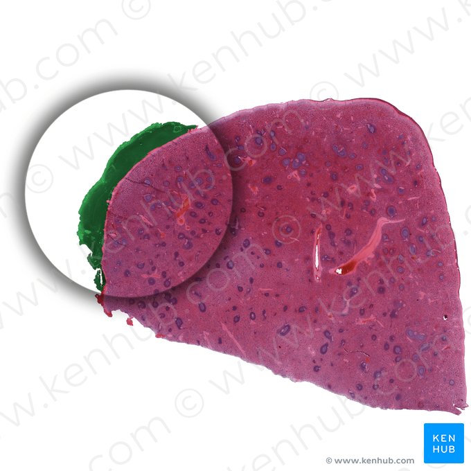 Hilum splenis (Milzhilus); Bild: 