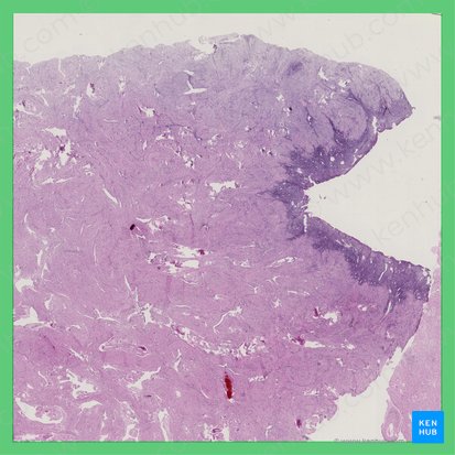 Early proliferative phase (Uterus) (Phasis proliferativa incipiens (Uterus)); Image: 