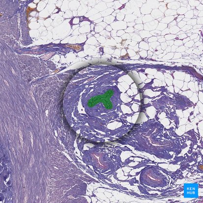 Rama de la arteria apendicular (Ramus arteriae appendicularis); Imagen: 