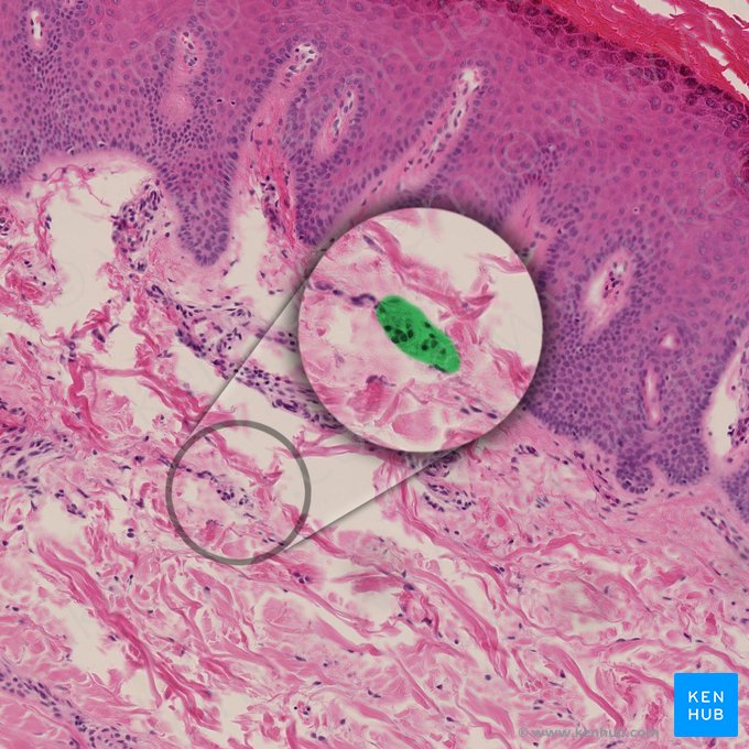 Bulbous (Ruffini) corpuscle (Corpusculum sensorium fusiforme); Image: 