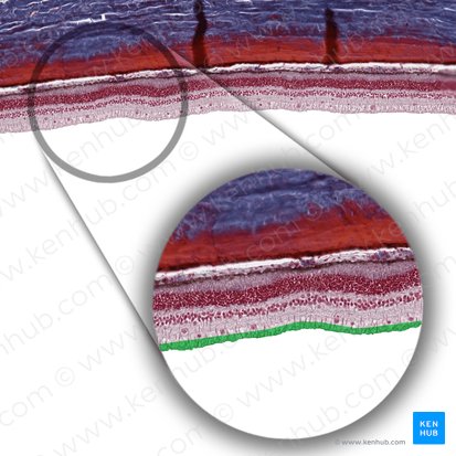Layer of nerve fibers of retina (Stratum neurofibrarum retinae); Image: 