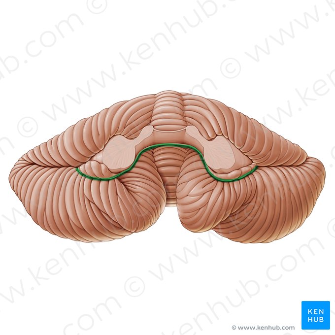 Posterolateral fissure of cerebellum (Fissura posterolateralis cerebelli); Image: Paul Kim