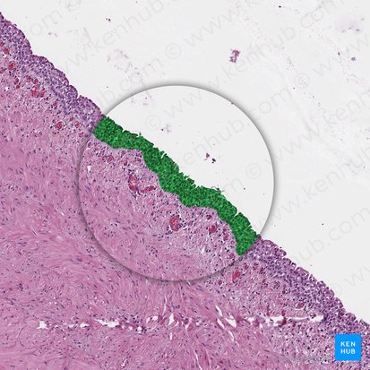 Urotelio (Urothelium); Imagen: 