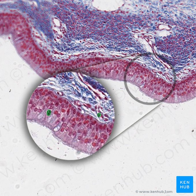 Mast cell (Mastocytus); Image: 