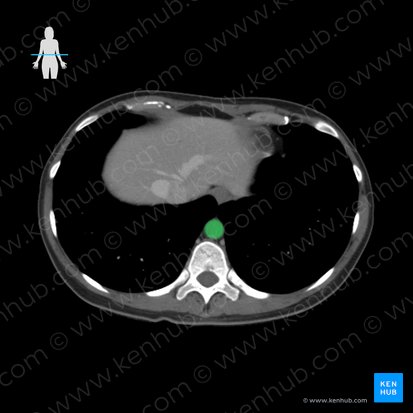 Aorta descendente torácica (Aorta thoracica descendens); Imagem: 