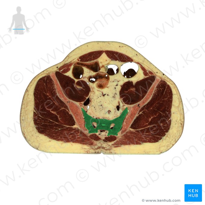 Sacrum (Os sacrum); Image: National Library of Medicine