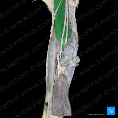 Musculus brachialis (Oberarmmuskel); Bild: 