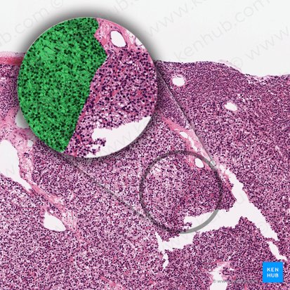Pale principal cell (Parathyrocytus endocrinus lucidus); Image: 