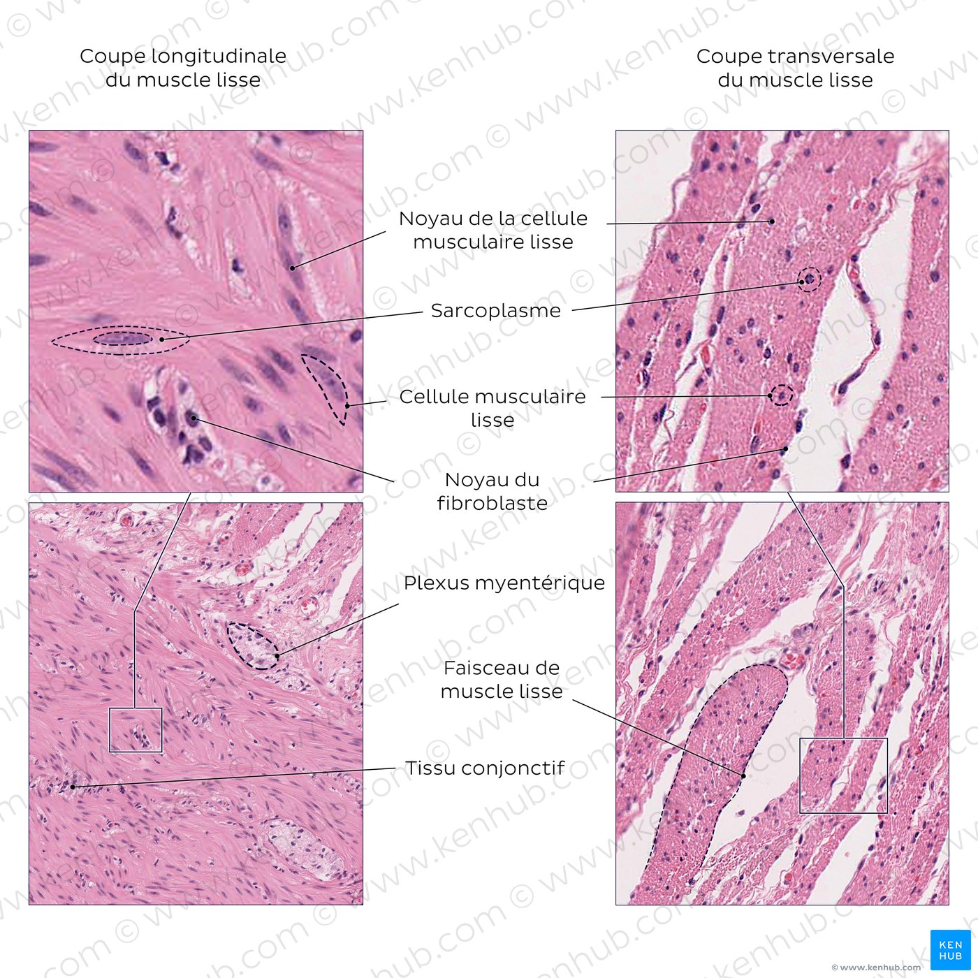Smooth muscle. Stain: H&E. Medium and high magnification.