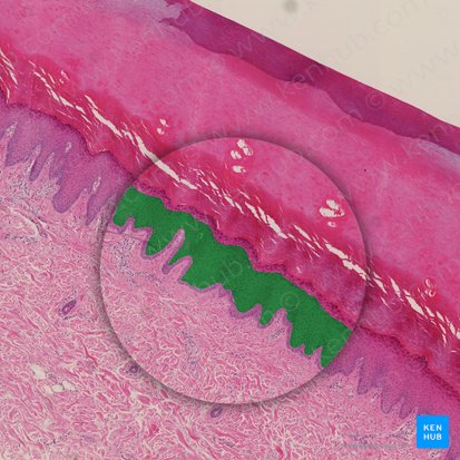 Stratum spinosum of epidermis (Stratum spinosum epidermis); Image: 