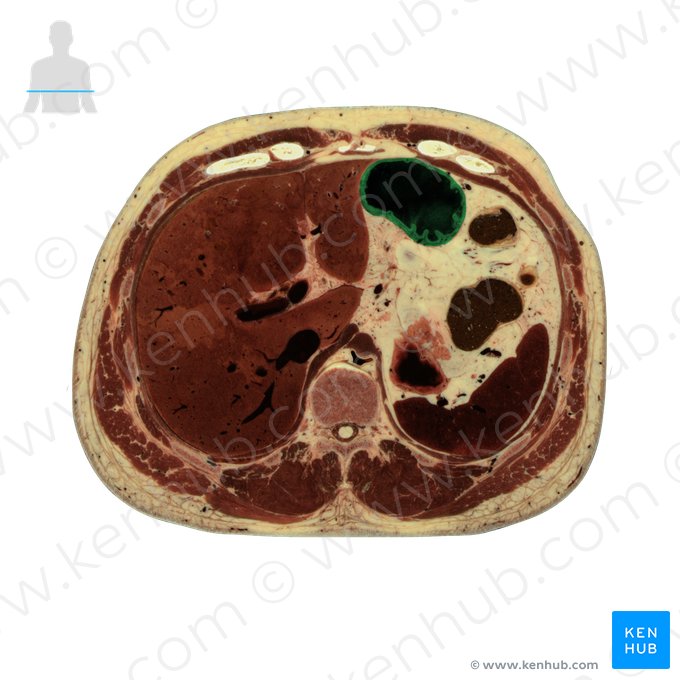 Pyloric part of stomach (Pars pylorica gastris); Image: National Library of Medicine