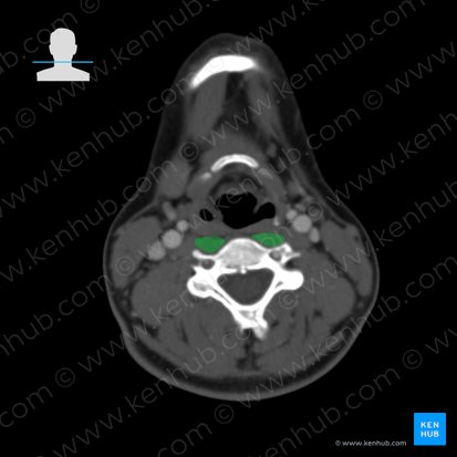 Longus colli muscle (Musculus longus colli); Image: 
