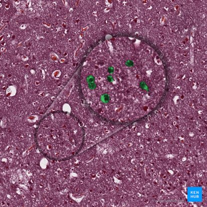 Neura (Neurone); Bild: 