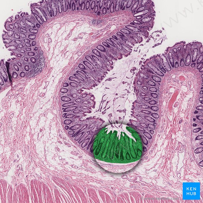 Mucosa (Tunica mucosa); Image: 