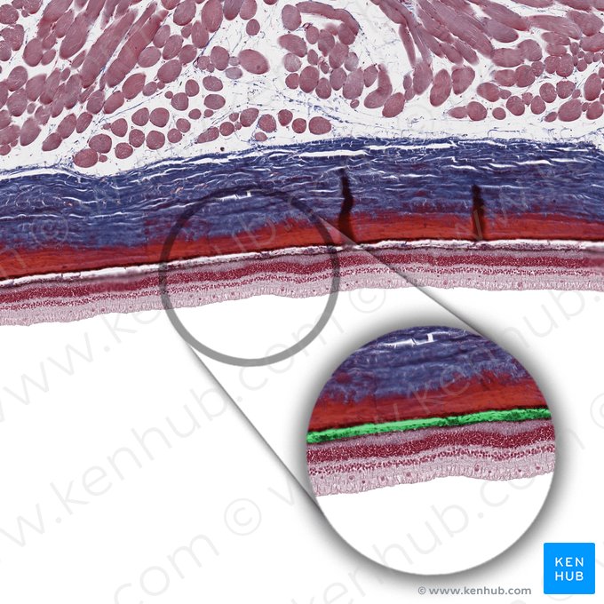 Basal complex of choroid (Complexus basalis choroideae); Image: 