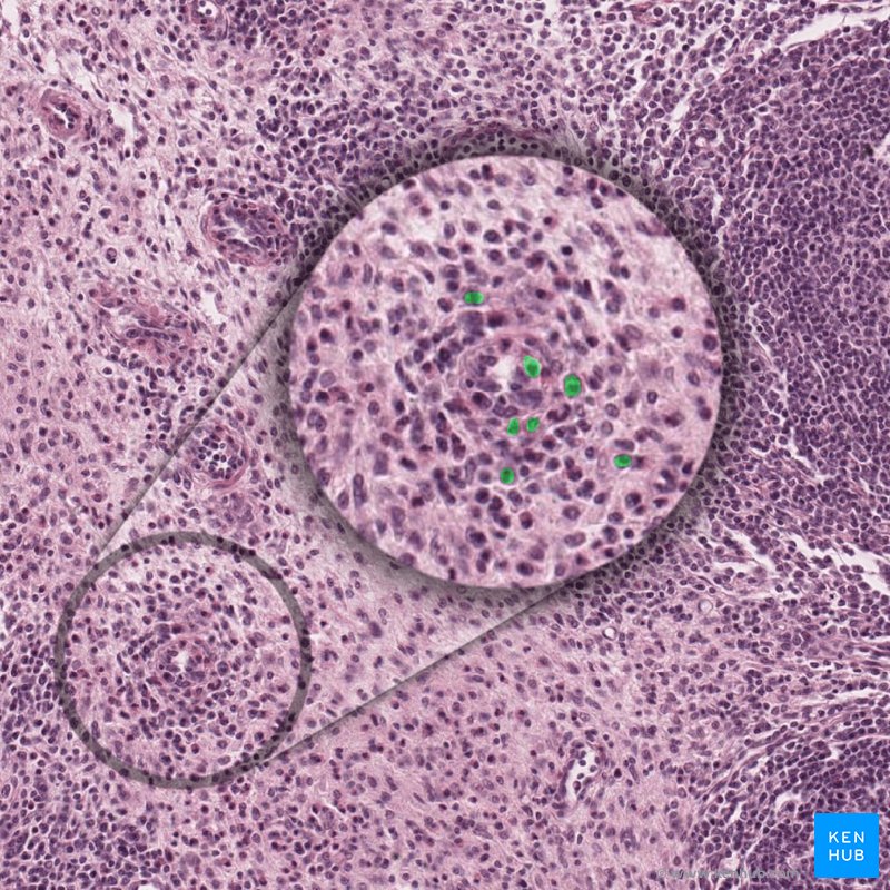 Plasma cells - histological slide
