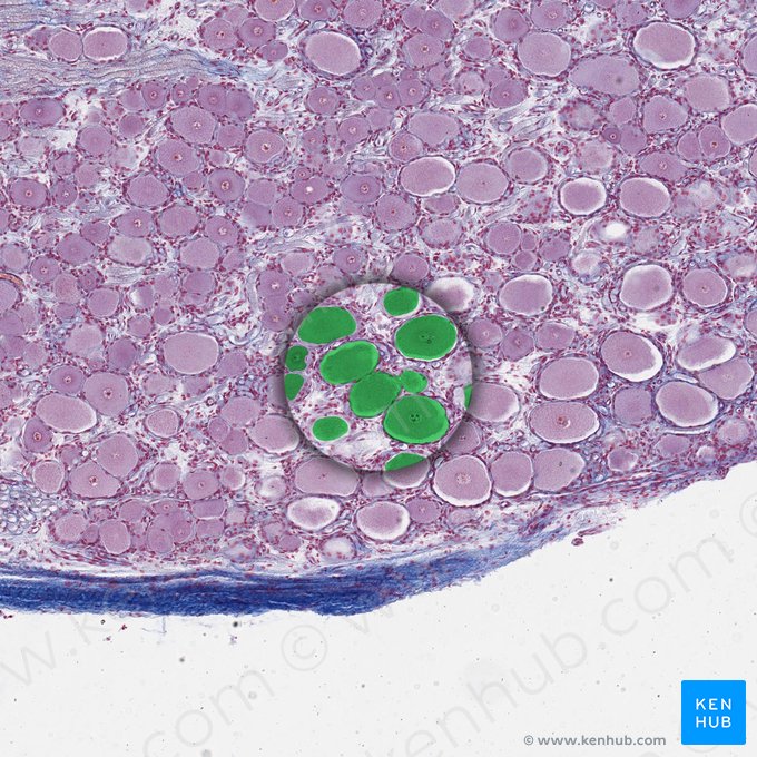 Pseudounipolar neuron (Neuron pseudounipolare); Image: 