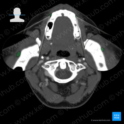 Vestíbulo oral (Vestibulum oris); Imagem: 