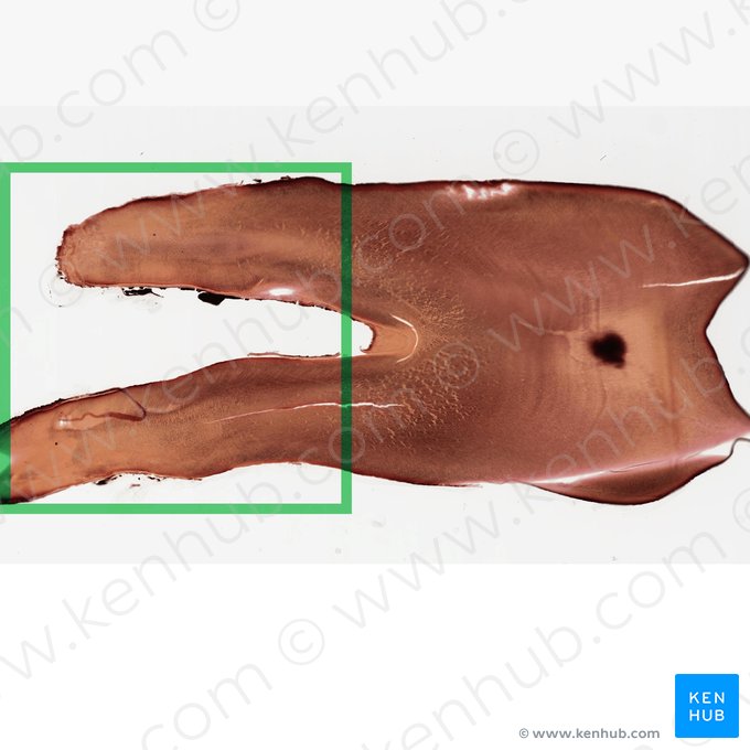 Root of tooth (Radix dentis); Image: 