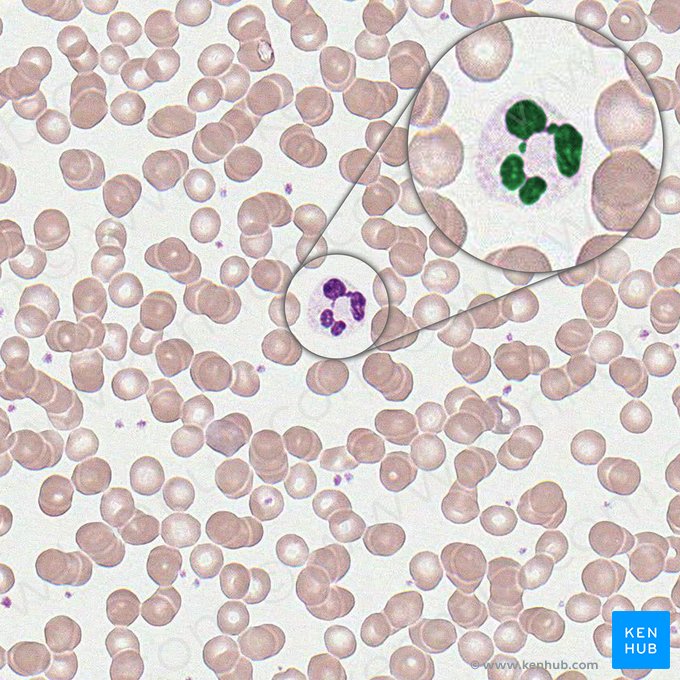 Nucleus multilobatus neutrophili (Segmentkerniger Granulozyt); Bild: 
