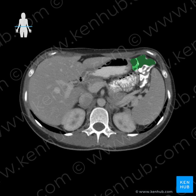 Cólon transverso (Colon transversum); Imagem: 