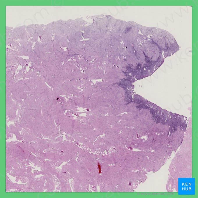 Early proliferative phase (Uterus) (Phasis proliferativa incipiens (Uterus)); Image: 