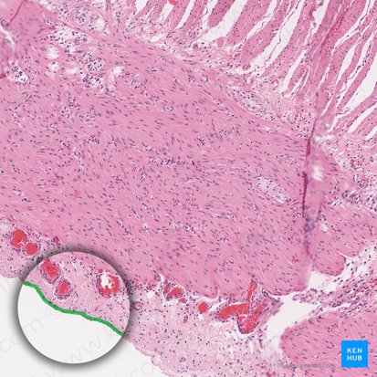 Mesotelio del peritoneo visceral (Mesothelium peritonei visceralis); Imagen: 