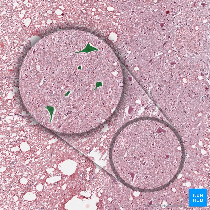 Cell body of motor neuron (Soma motoneuri); Image: 